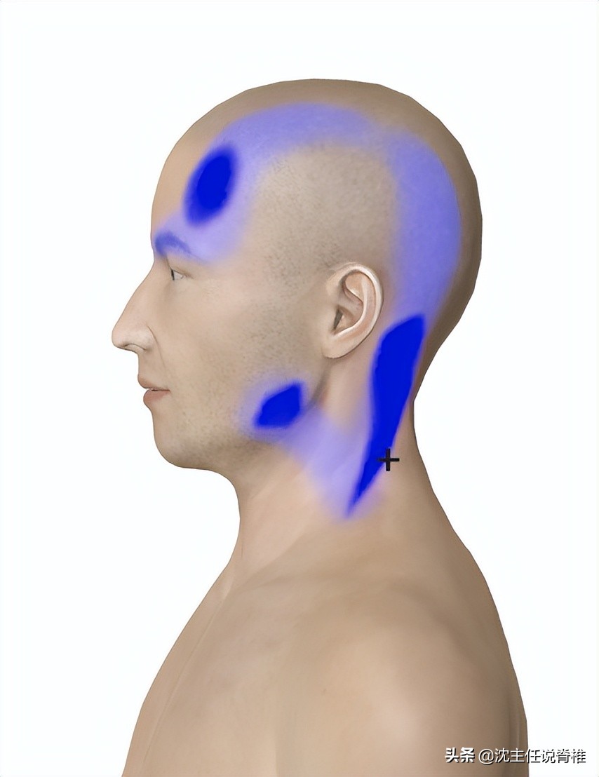 太阳穴疼痛警惕四种病,太阳穴周围疼痛是什么病的预兆