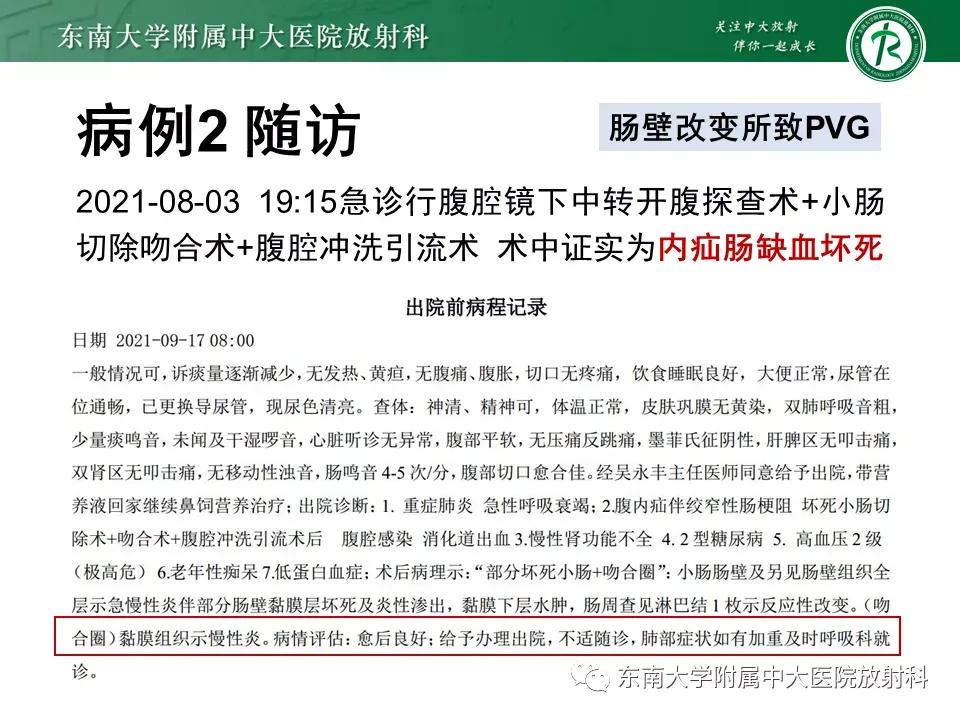 门静脉积气什么意思,好文分享深度揭秘