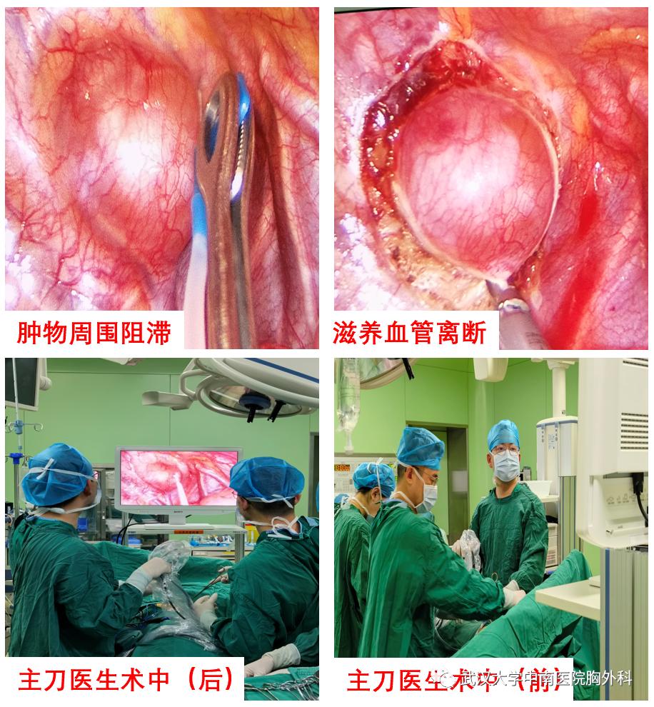 日间手术|患者从入院到出院只需一天！你了解日间手术吗？