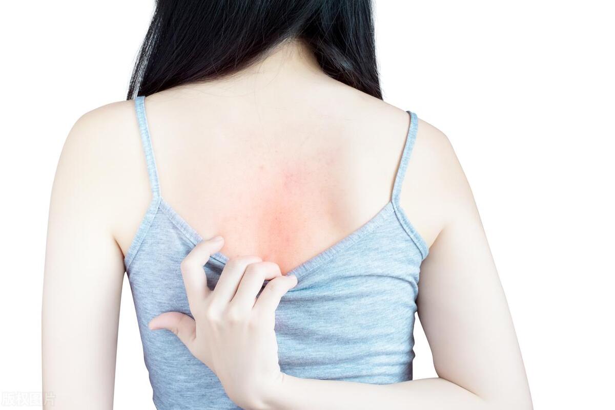 血常规中嗜酸性粒细胞升高要警惕,血热做血常规什么指标会升高