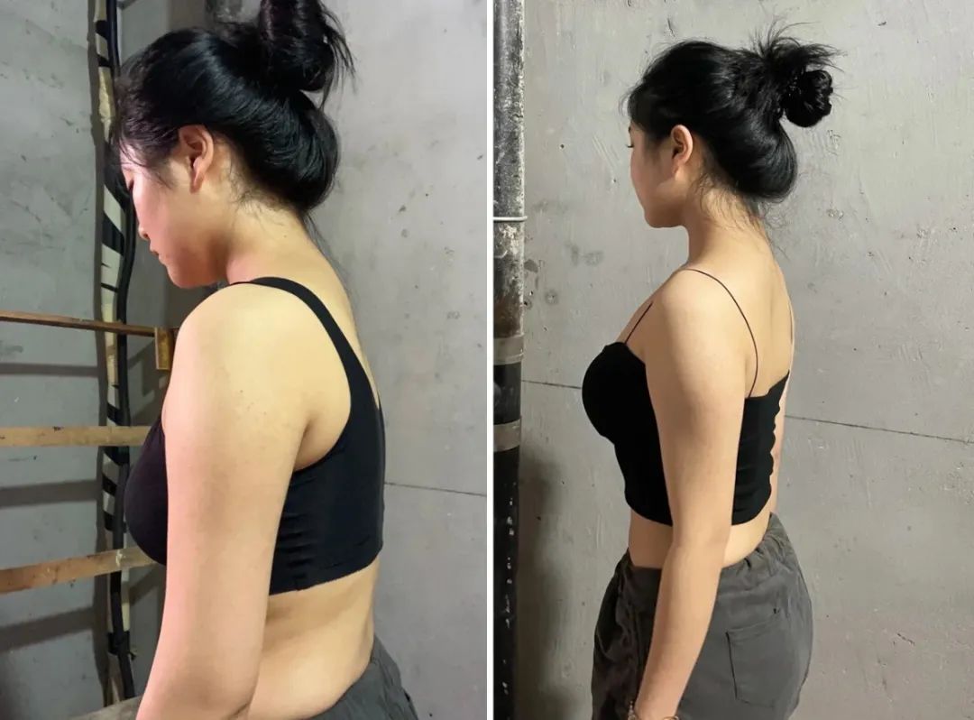 看起来胖实际没多重,胖有可能也是营养不良图文