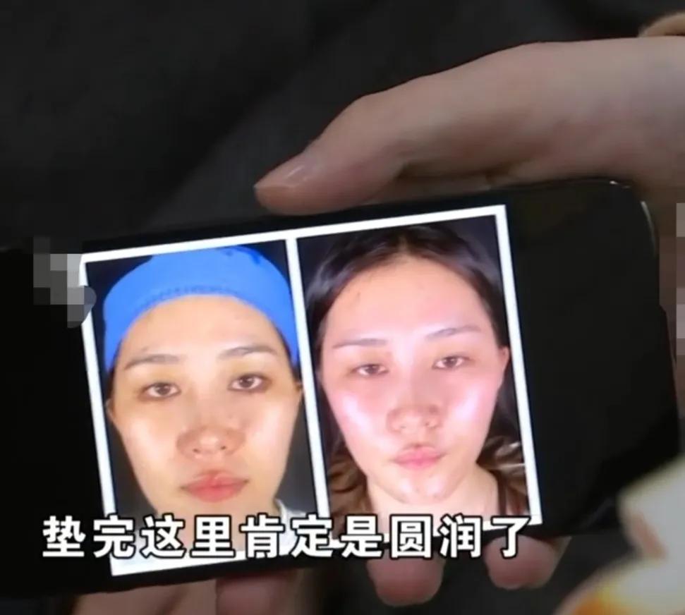 杨女士花了近16万，做面部美容，不但没有效果，而且脸部溃烂。