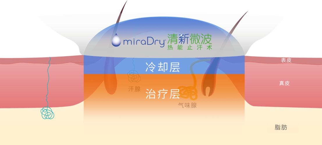 治疗狐臭微波用多少钱,清新微波治狐臭价格