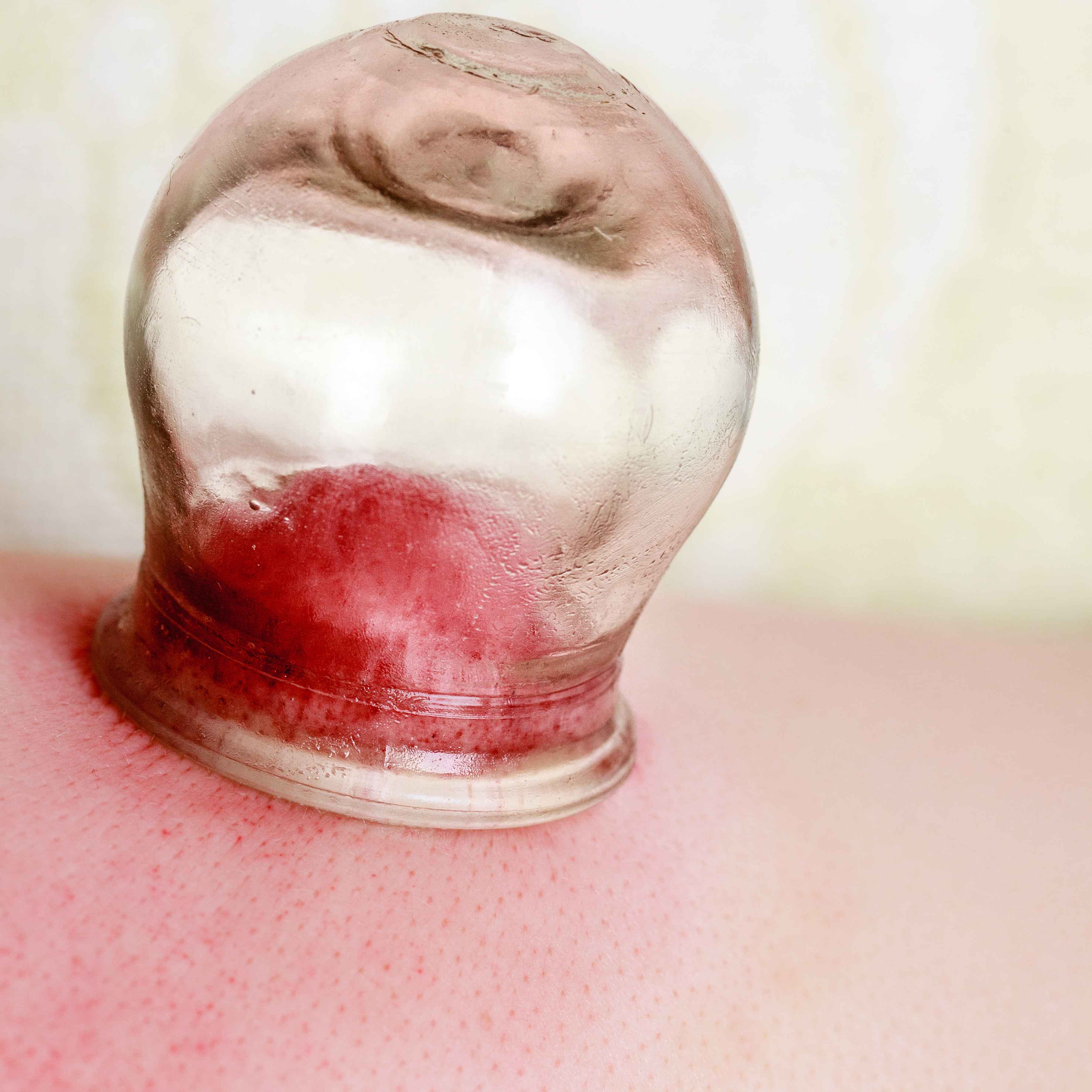 脸与头发爱出油是什么原因引起的,头发和脸部出油厉害是什么原因