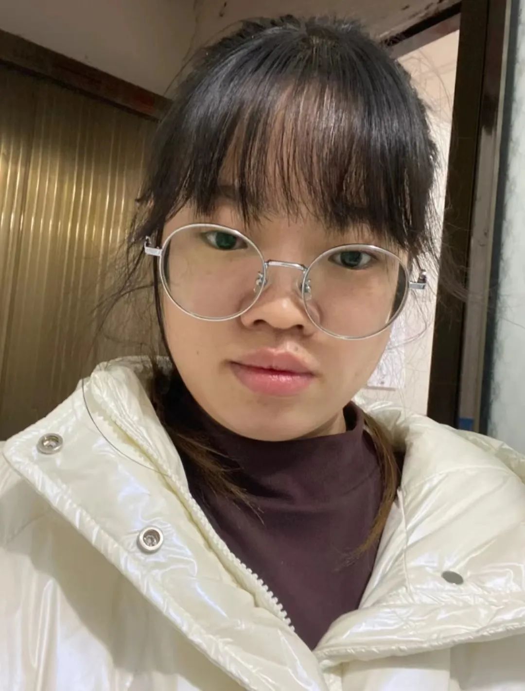 塌鼻子正脸好看,塌鼻子该如何变美啊