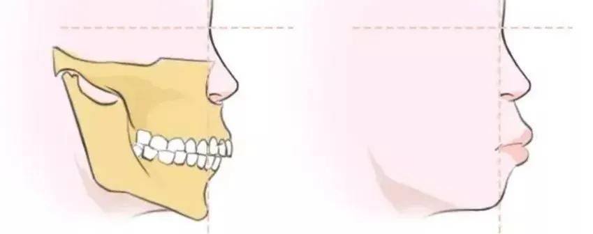 国民初恋毁容了,国民初恋盛世美颜