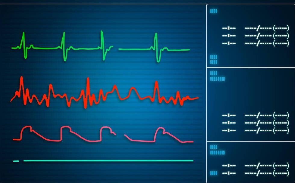 糖尿病合并心血管疾病，不过是心脉瘀堵了，一方益气养阴，通心脉