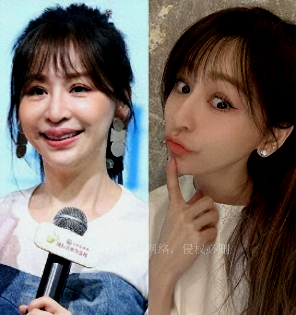 震惊啊！台湾艺人整形记：换脸削骨小场面，嫁给医师保修终身