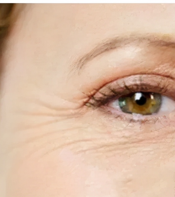 奖门人提醒：别叫“纹”题成问题，皮肤科医生教您抵抗岁月痕迹