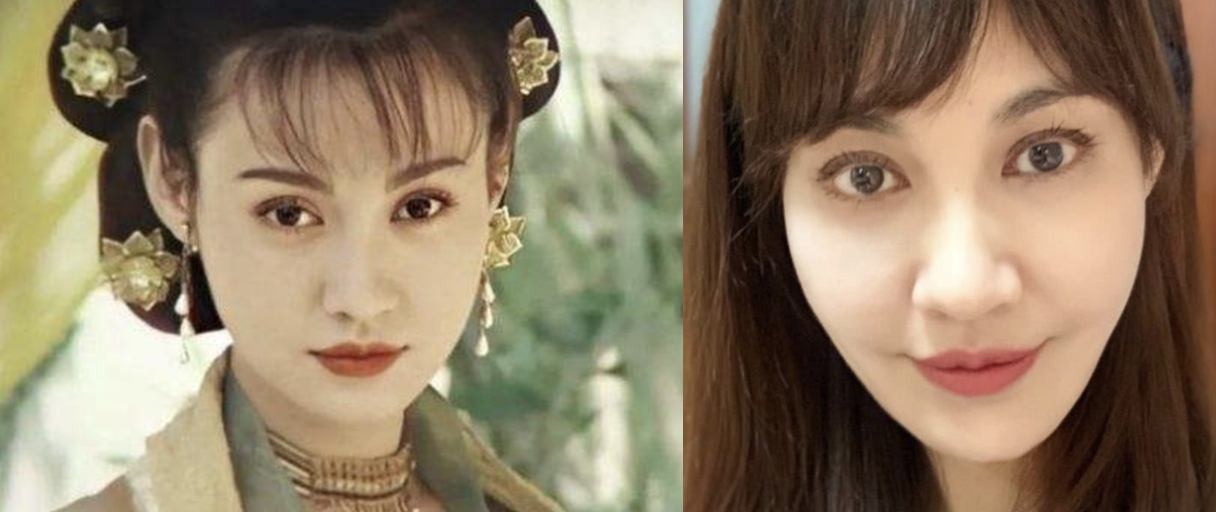 老演员整容脸变形,老年人整容前后照片