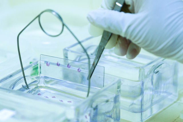 我的肺癌治愈了吗：术后液体活检