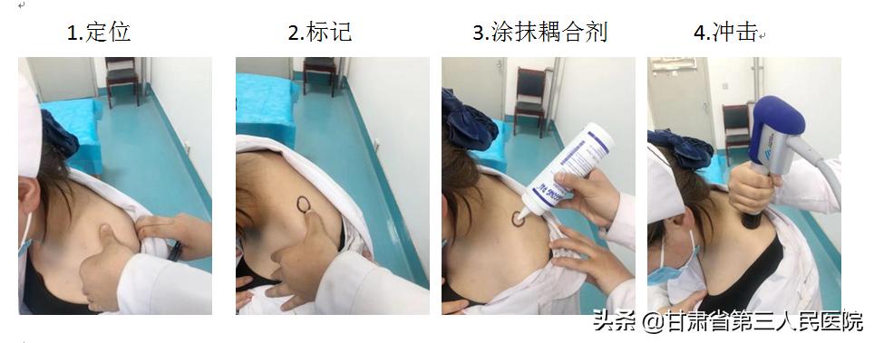用冲击波治疗疼痛的副作用,冲击波治疗疼痛后注意事项