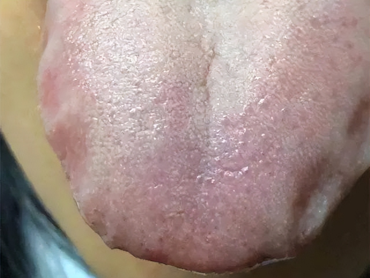 参苓白术丸补中益气丸哪个效果好,参苓白术丸哪个药效好