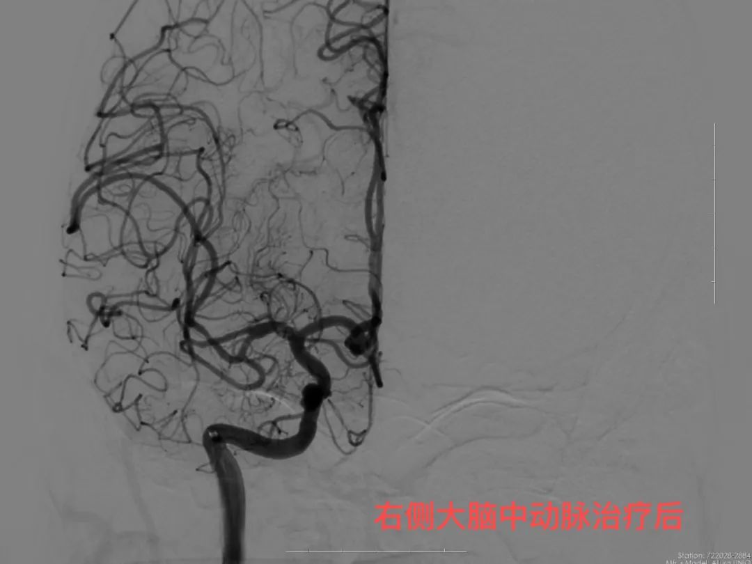 济南市莱芜人民医院口镇分院,山东打通生命通道济南