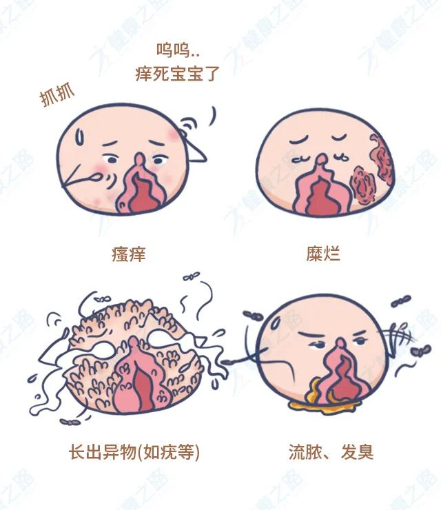 下面发痒、长疙瘩,是性病吗?还能治好吗?