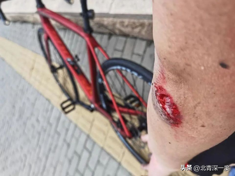 骑行摩托车摔了,摔车后骑行不舒服