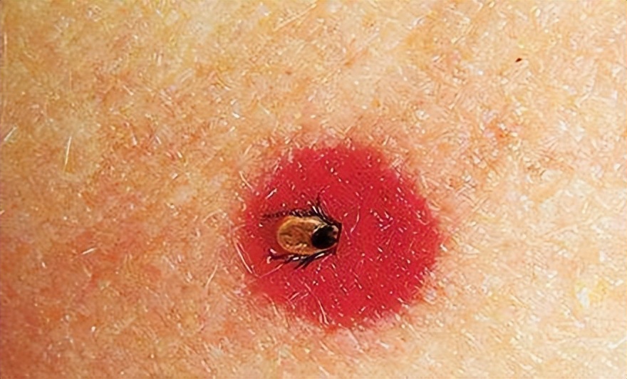 室内灭跳蚤的特效药,室内消灭跳蚤