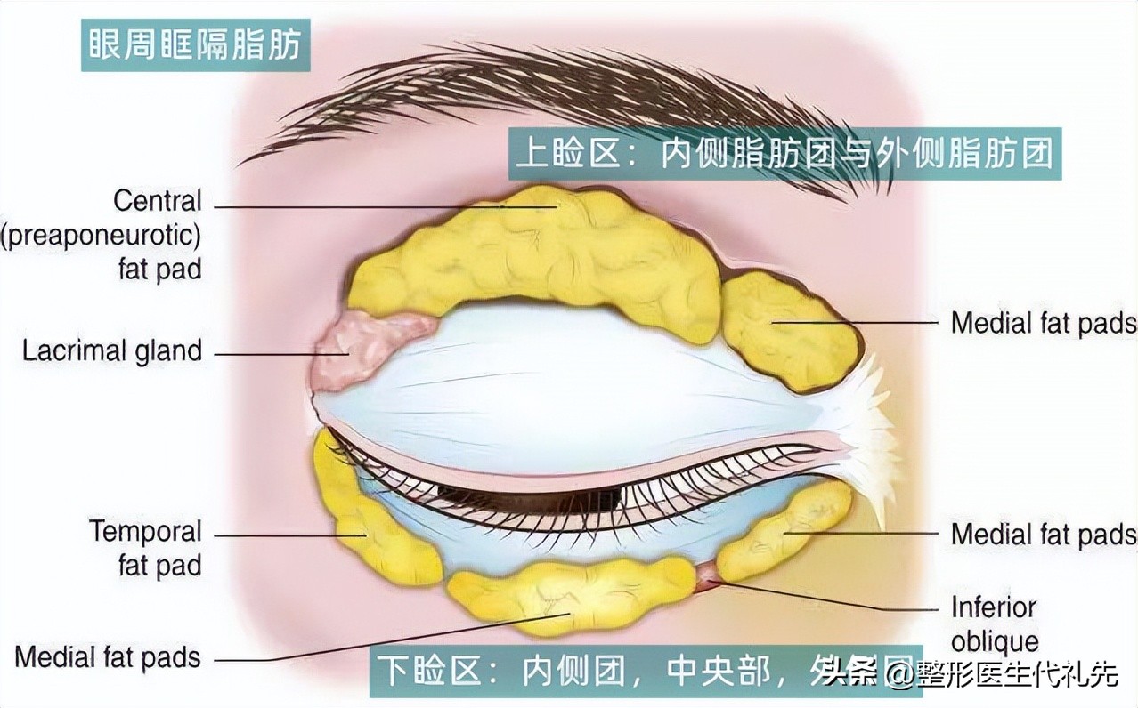 下眼窝凹陷的原因及解决方法,眼窝凹陷怎么回事