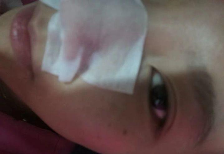 鼻子上有黑点怎么抠掉,鼻子边缘的小白点怎么去除