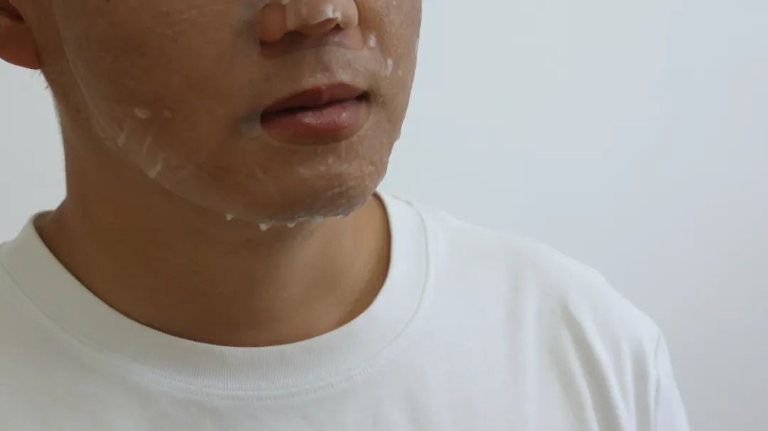 脸部总是干燥起皮怎么办,脸部干燥爆皮用什么修复