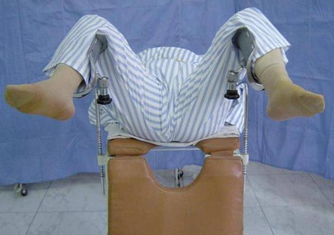 阴道镜—妇科医生的“火眼金睛”，宫颈癌的“照妖镜”