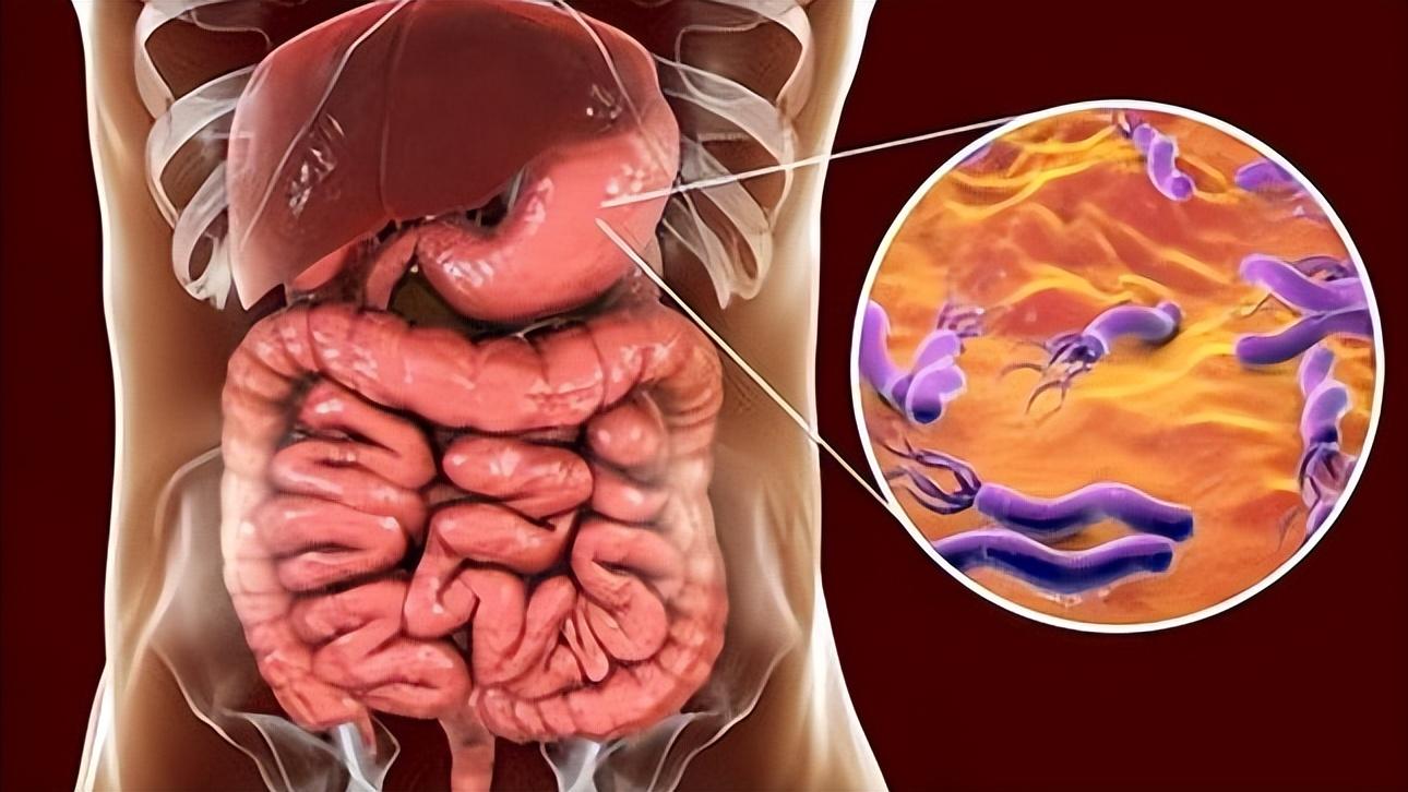 胃炎三分治七分养，医生直言：胃炎患者改善饮食才是最大的良药