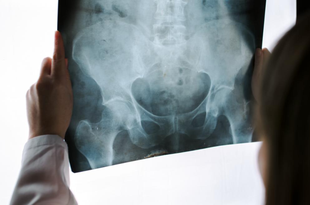 外阴处变肥大怎么回事,女外阴肥大有什么影响