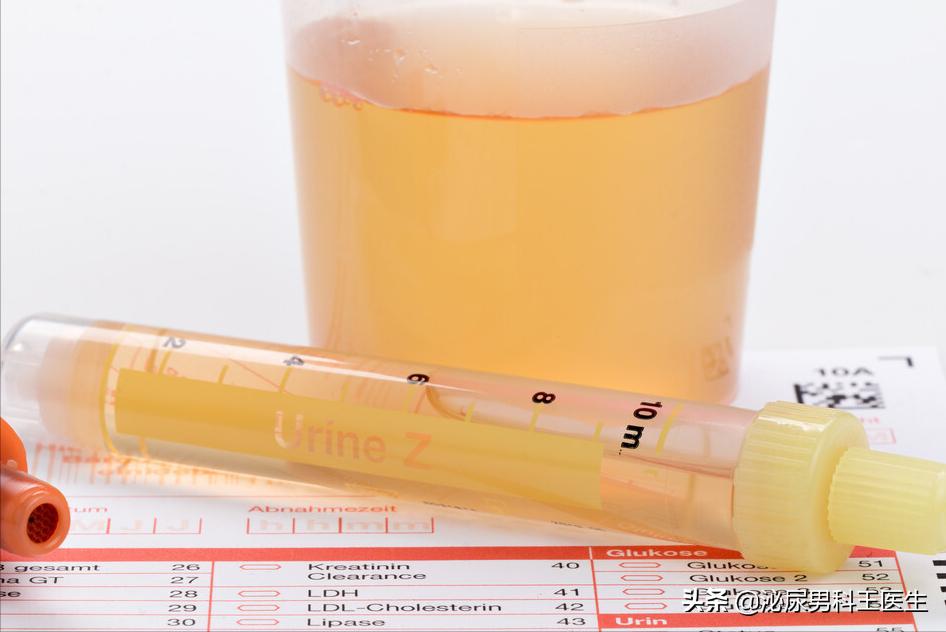 治疗前列腺增生最好的三种药,前列腺增生钙化吃什么药物有效