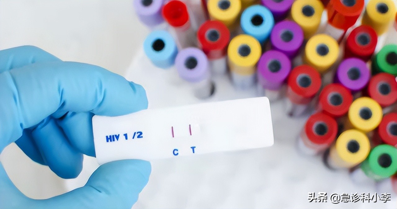 老年人感染艾滋病的高危行为,越来越多的老人得艾滋病