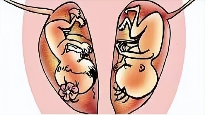 24岁女子体检发现有两个子宫,女子婚前体检却显示怀孕2个月