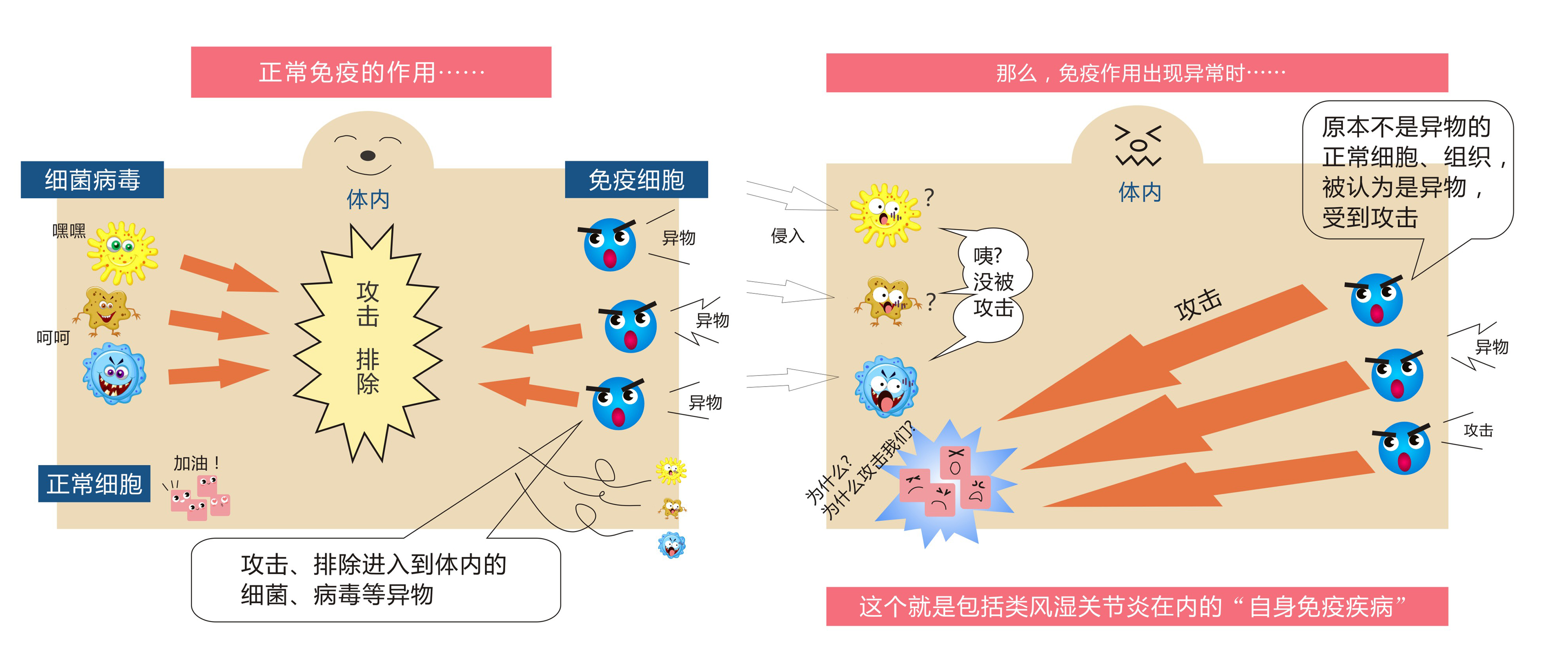 类风湿最有效的理疗方法,治类风湿用免疫吸附能调节免疫吗