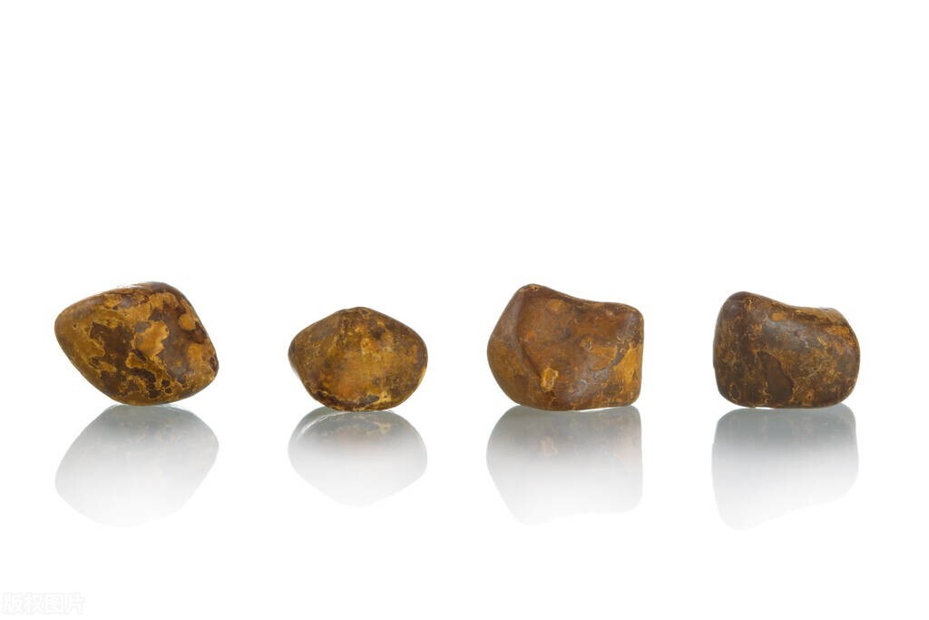 肾结石和肝血管瘤饮食禁忌,肾结石和高血糖饮食禁忌有哪些