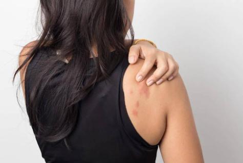 妻子对丈夫的精华过敏，还能同房和生娃么？听听医生怎么说