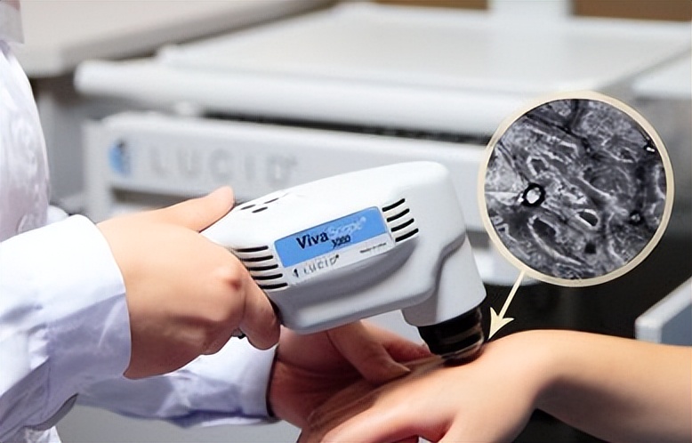 担心！身上出现白癜风该怎么办？这几点一定要注意