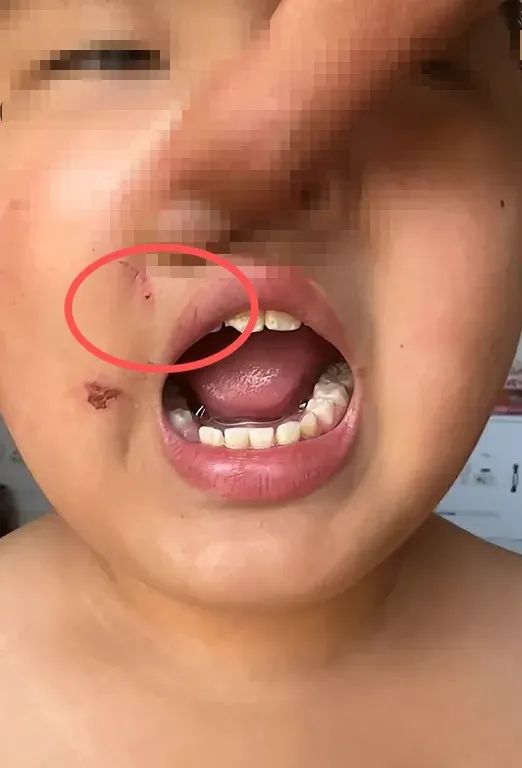 小学生被老师体罚致抢救,9岁小学生被老师体罚