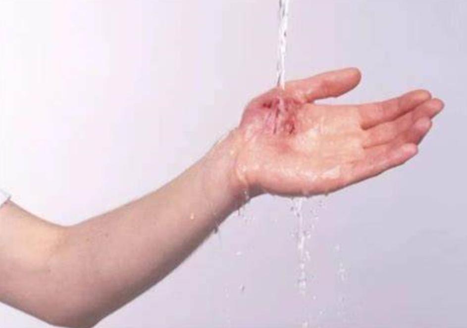 婴儿不小心摔倒了要怎么处理,宝宝不小心摔跤了大人怎么做正确