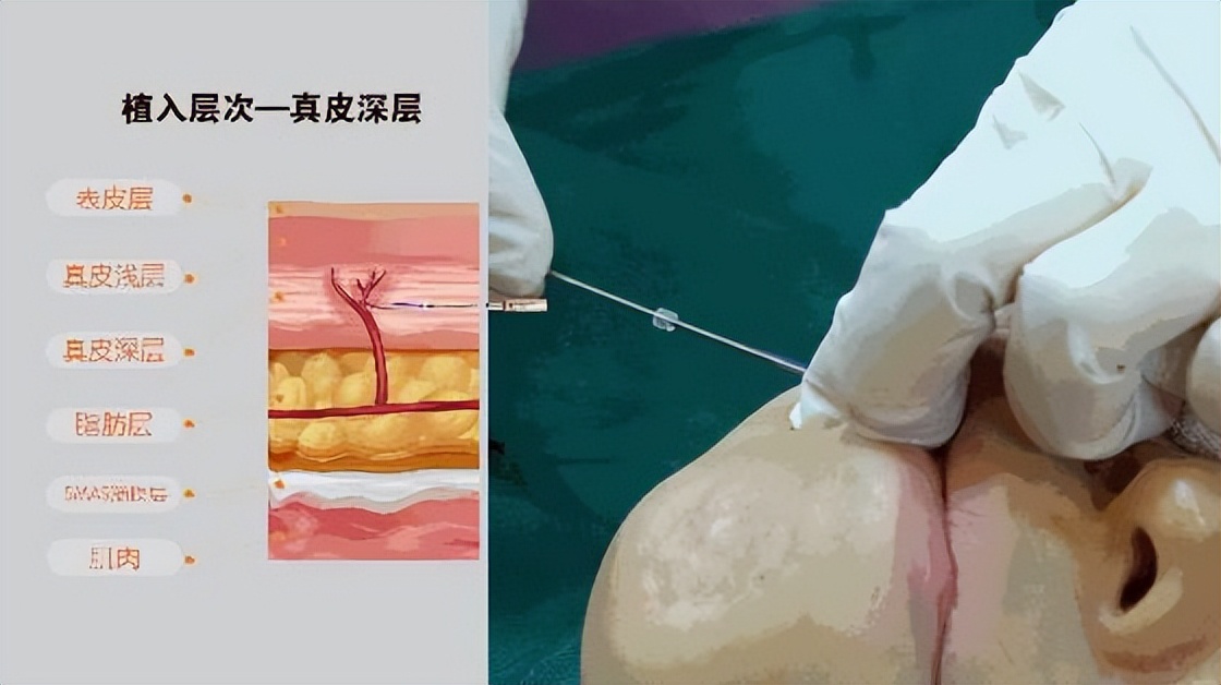 看下颌角知道自己什么脸型,看下颚线判断脸型