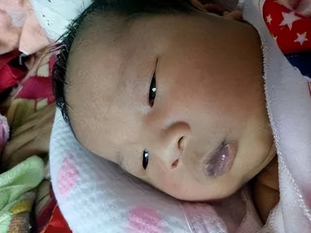 宝宝嘴唇发紫是什么病的预兆,宝宝嘴唇发紫是什么原因该怎么办