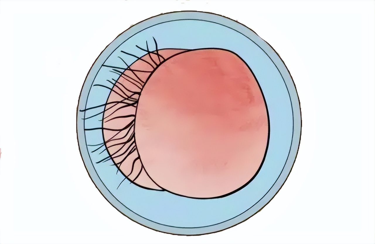 菊花痒到坐立难安？可能是肛毛太多惹的祸