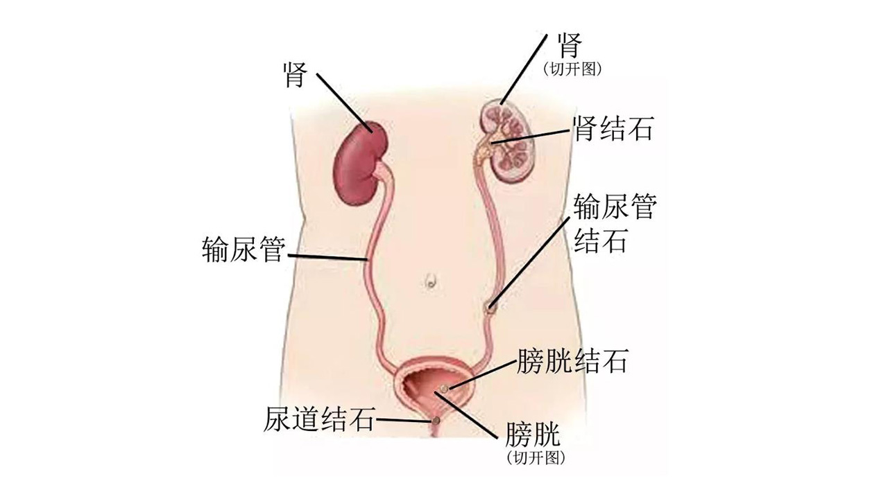 速效救心丸治什么心脏病,速效救心丸可以用于各种心脏病吗