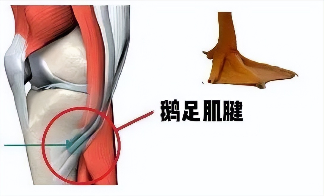 膝盖髌骨软骨疼痛部位对照表,膝盖下方胫骨疼痛部位对照表