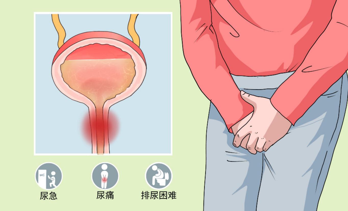 内衣经常湿的会引起疾病吗,内衣湿湿的是怎么回事