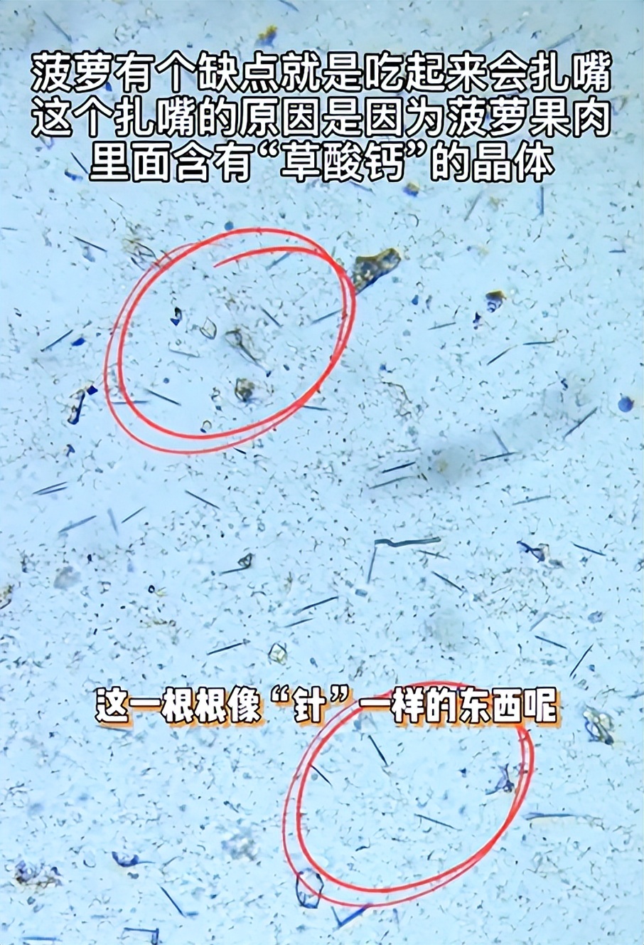 吃菠萝嘴巴舌头刺痛怎么办,吃菠萝嘴扎了很疼怎么办