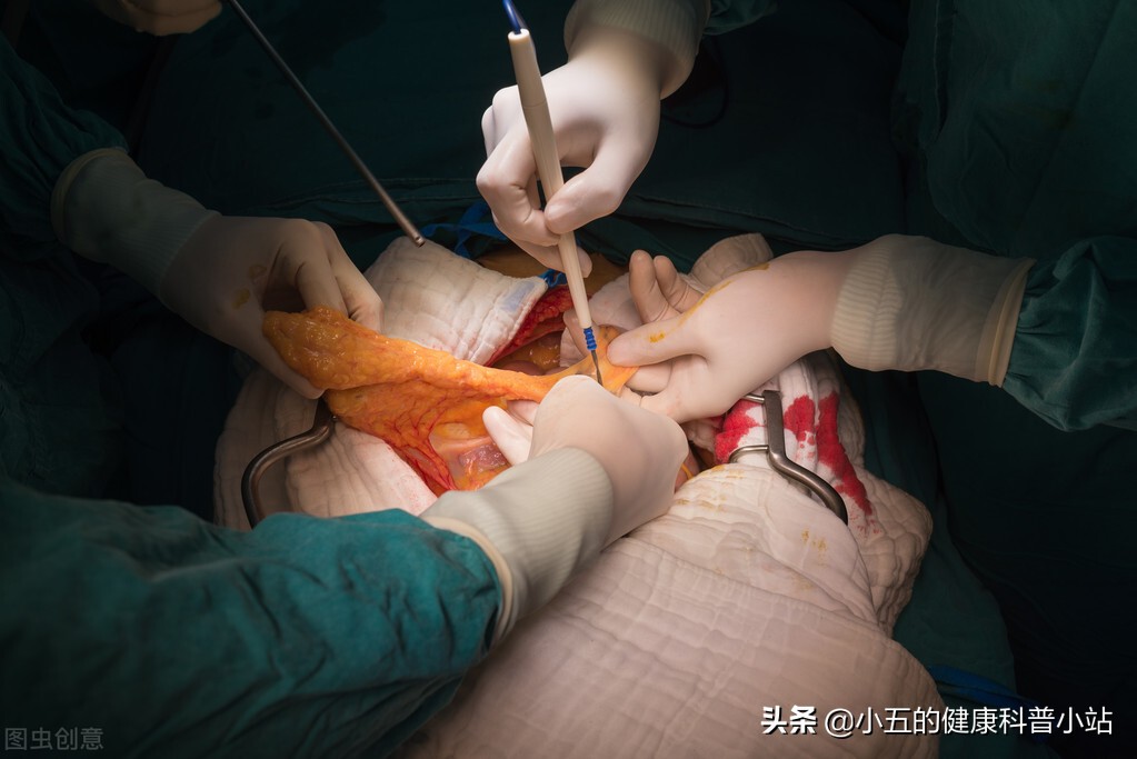 麻仁软胶囊是治疗老年便秘的常用药,能长期服用吗?一文说清