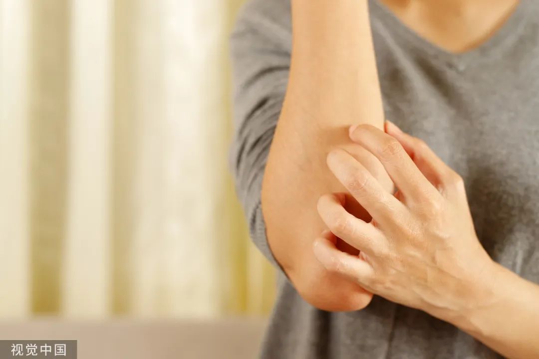 太爱干净容易过敏,过敏的人为什么越来越多