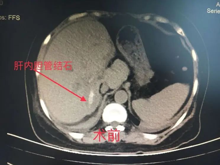 医患故事七面锦旗述说生命奇迹,医院锦旗故事