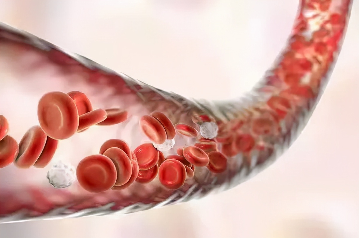 缺血性脑卒中如何治疗好,什么是缺血性脑卒中最常见的类型