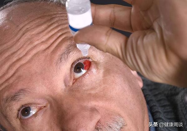 结膜炎红眼病怎么好得快,结膜炎和红眼病的症状有什么不同