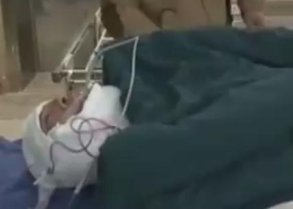 62岁大叔喝出河马脖,辽宁男子喝酒成河马