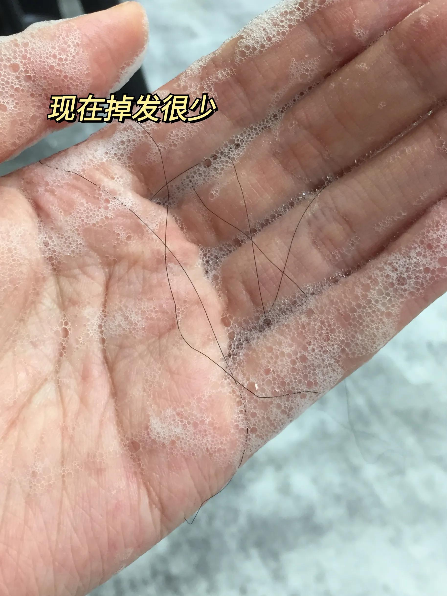 炸毛很厉害可以做柔顺解决么,炸毛翘起来怎么办